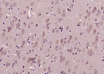 PLVAP Rabbit Polyclonal Antibody
