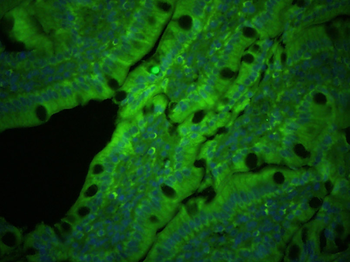 PLVAP Rabbit Polyclonal Antibody
