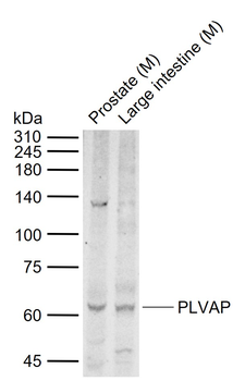 PLVAP Rabbit Polyclonal Antibody