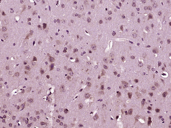 PMM2 Rabbit Polyclonal Antibody