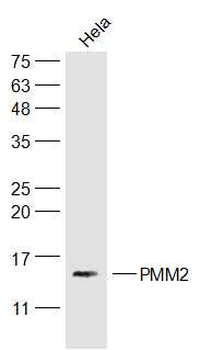 PMM2 Rabbit Polyclonal Antibody