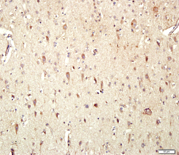ADRB1 Rabbit Polyclonal Antibody
