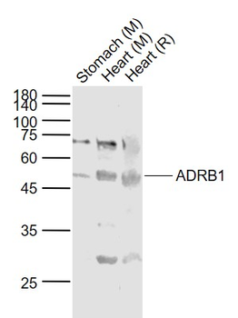 ADRB1 Rabbit Polyclonal Antibody