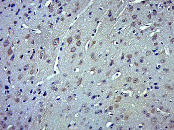 QSOX2 Rabbit Polyclonal Antibody