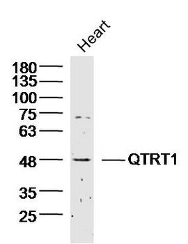 QTRT1 Rabbit Polyclonal Antibody