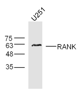 RANK Rabbit Polyclonal Antibody