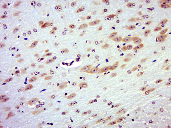 RAB3IL1 Rabbit Polyclonal Antibody