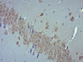 Rabenosyn 5 Rabbit Polyclonal Antibody