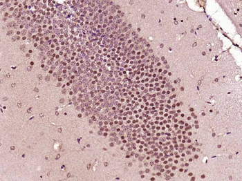 RBM17 Rabbit Polyclonal Antibody