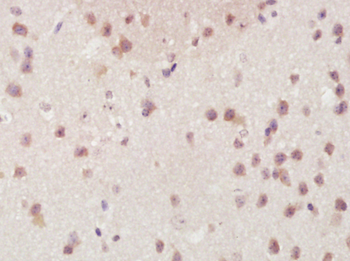 RBM22 Rabbit Polyclonal Antibody