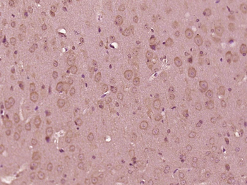 RBM25 Rabbit Polyclonal Antibody