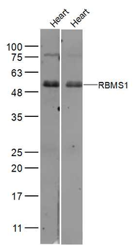 RBMS1/Cervical cancer oncogene 4 Rabbit Polyclonal Antibody