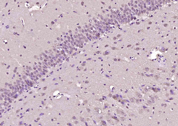 RBMXL1 Rabbit Polyclonal Antibody