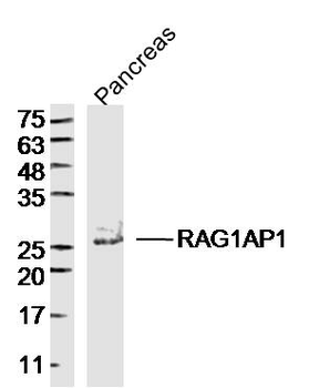 RAG1AP1 Rabbit Polyclonal Antibody