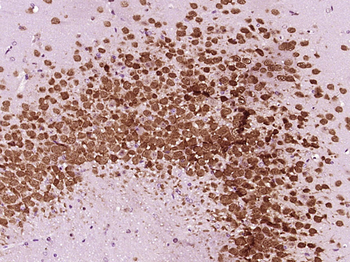 SAP18 Rabbit Polyclonal Antibody