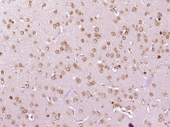 SAP18 Rabbit Polyclonal Antibody