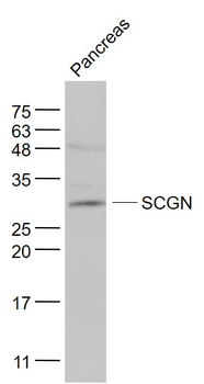 SCGN Rabbit Polyclonal Antibody