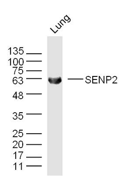 SENP2 Rabbit Polyclonal Antibody
