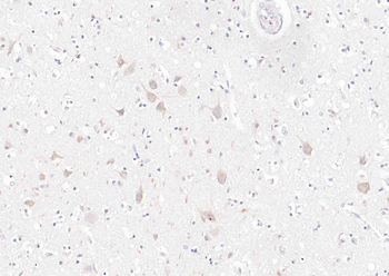 Synaptophysin Rabbit Polyclonal Antibody