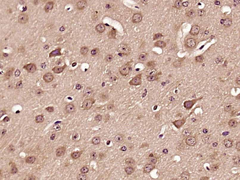 Synaptophysin Rabbit Polyclonal Antibody