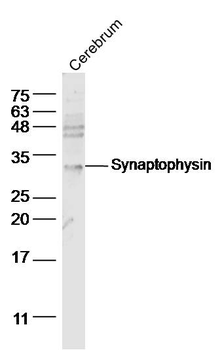 Synaptophysin Rabbit Polyclonal Antibody
