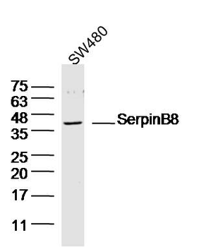 SerpinB8 Rabbit Polyclonal Antibody
