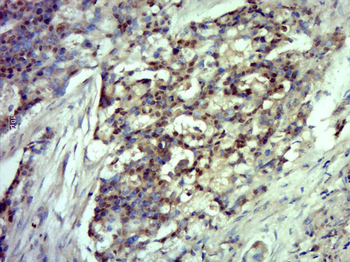 SFPQ Rabbit Polyclonal Antibody