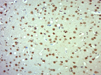 SFPQ Rabbit Polyclonal Antibody