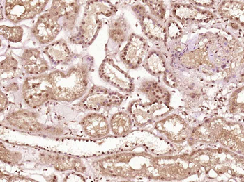 SH3BP2 Rabbit Polyclonal Antibody