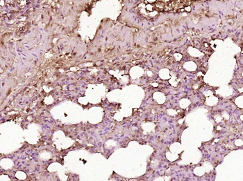 SH3BP2 Rabbit Polyclonal Antibody