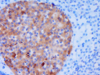 SH3BP4 Rabbit Polyclonal Antibody