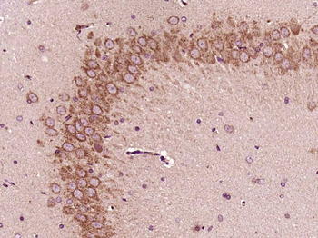 SH3GL2/Endophilin A1 Rabbit Polyclonal Antibody