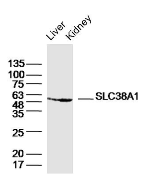SLC38A1 Rabbit Polyclonal Antibody