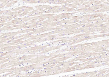 SLC39A14 Rabbit Polyclonal Antibody