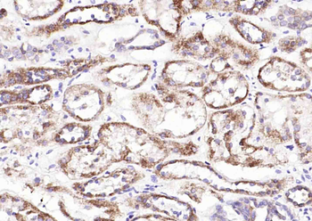 SLC39A14 Rabbit Polyclonal Antibody