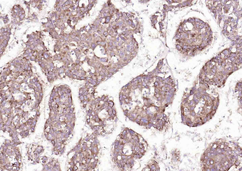 SLC39A14 Rabbit Polyclonal Antibody