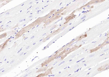 SLC39A14 Rabbit Polyclonal Antibody