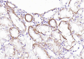 SLC39A14 Rabbit Polyclonal Antibody