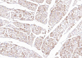 SLC39A14 Rabbit Polyclonal Antibody