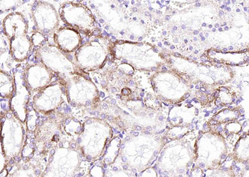SLC39A14 Rabbit Polyclonal Antibody