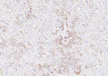 SLC39A14 Rabbit Polyclonal Antibody