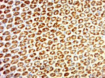 SLC39A4 Rabbit Polyclonal Antibody