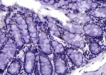 Phospho-Src (Ser75) Rabbit Polyclonal Antibody