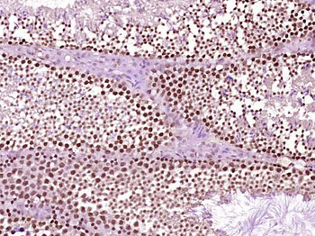 Phospho-Src (Ser75) Rabbit Polyclonal Antibody