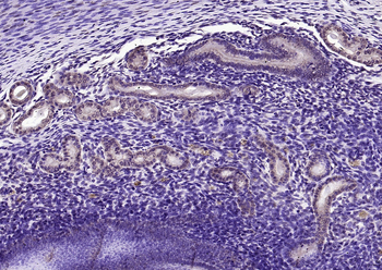 Phospho-Src (Ser75) Rabbit Polyclonal Antibody