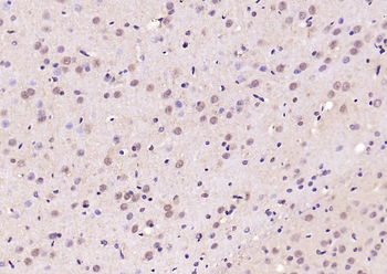 Phospho-Smad3 (Thr179) Rabbit Polyclonal Antibody