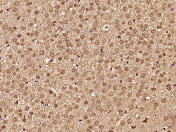 Phospho-Smad3 (Thr179) Rabbit Polyclonal Antibody
