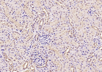 Phospho-Smad3 (Thr179) Rabbit Polyclonal Antibody
