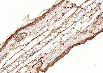 Phospho-Smad3 (Thr179) Rabbit Polyclonal Antibody