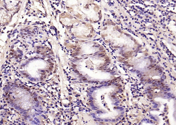 Phospho-Smad3 (Thr179) Rabbit Polyclonal Antibody